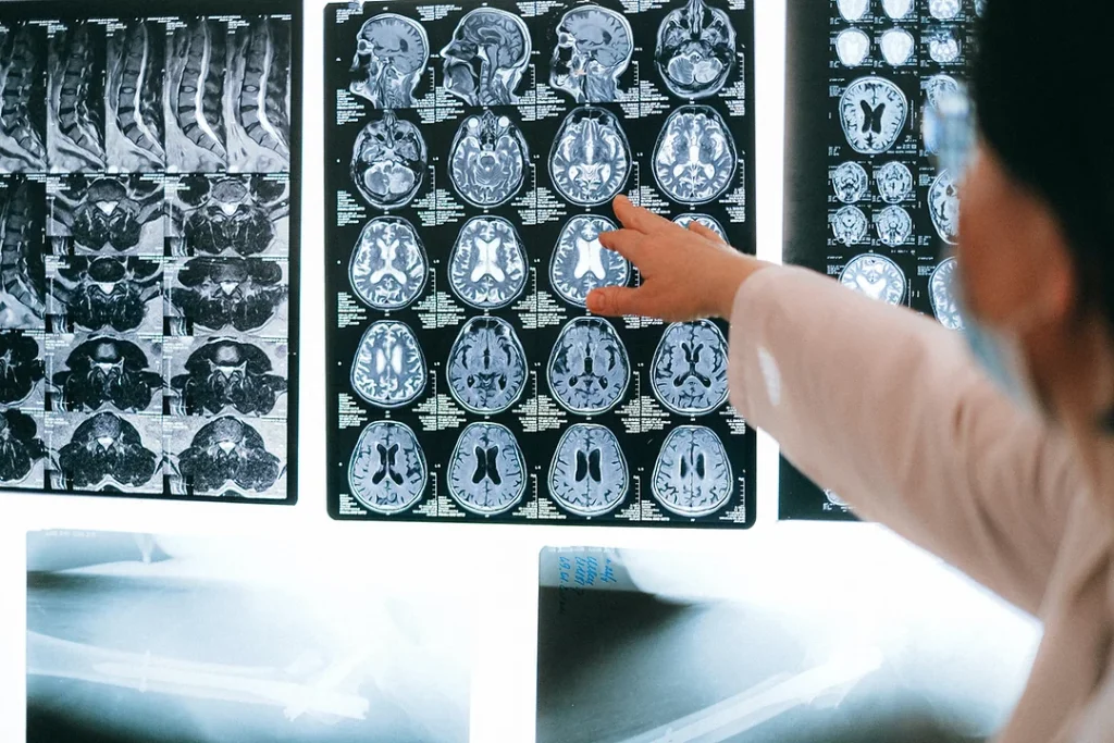 Doctor pointing to brain images during examination.