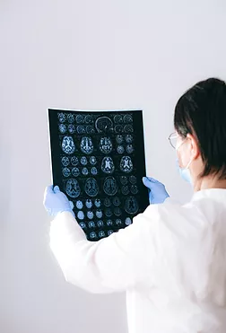 Image of a researcher examining a brain image.