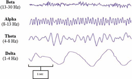 Image displaying EEG brain waves, depicting pulsating patterns.